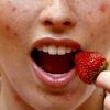 alergia alimentaria- modofun- síntomas