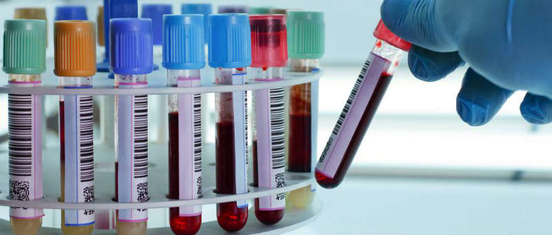 prueba de sangre-